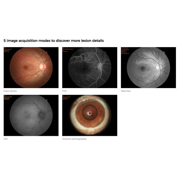 Multifunctional Digital Fundus Camera Photography Equipment Professional Grade