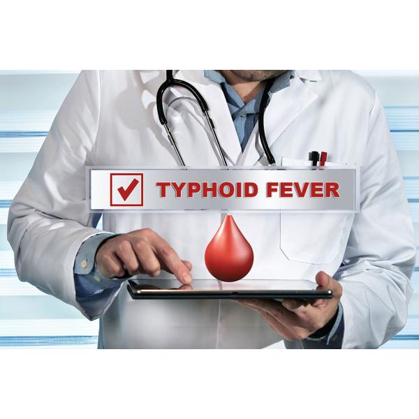 ISO 15min Qualitative Detection Plasma Typhoid IgG IgM Rapid Test