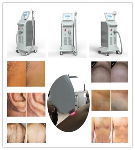 Buy NUBWAY Diode laser hair removal/ 808nm Diode laser Depilation/ 808nm diode laser NBW-L133 at wholesale prices