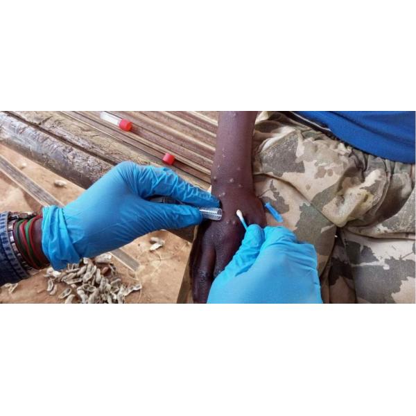 Mpox multi-enzyme constant temperature rapid nucleic acid amplification overall solution