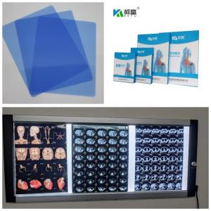 China CT DR MRI Inkjet Medical X Ray Film 3D Image Output 8x10 11x14  14X17 Inch on sale