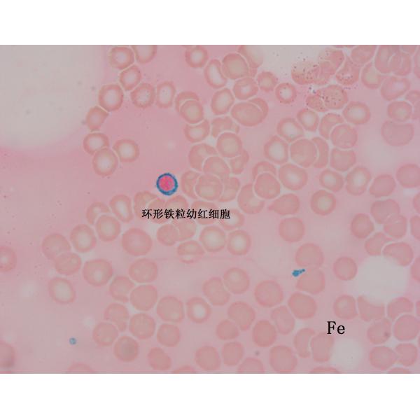 Iron Stain Kit Prussian Blue Staining Kit 20 Tests ISO Certified