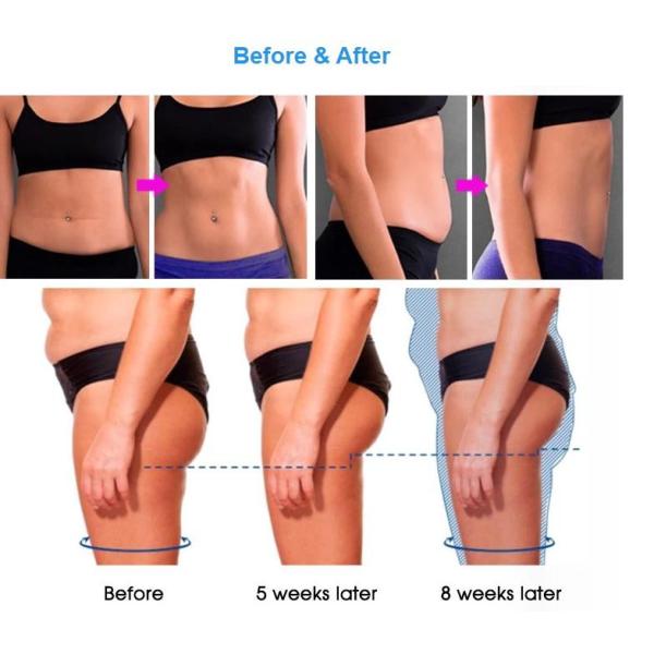 White Color Multifunction Beauty Machine Fat Reduction Device Non Invasive Technology