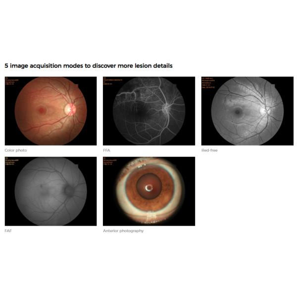Automated Digital Fundus Camera Non Mydriatic High Image Acquisition Efficiency