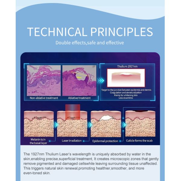 Compact Fractional CO2 Laser Machine Suitable for Clinics Specializing in Wrinkle Reduction and Skin Texture Improvement