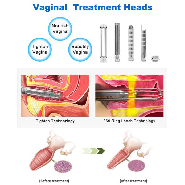 Advanced Four Treatment Modes Co2 Fractional Laser Machine Effective Stretch Marks Removal