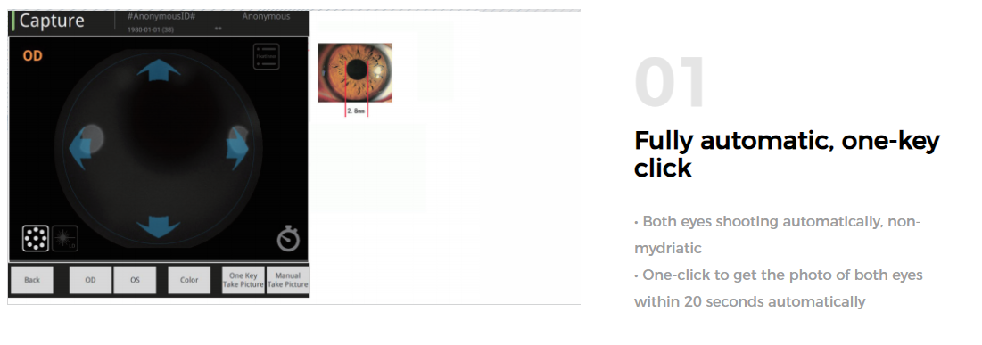 Non Mydriatic Fundus Camera With Auto Focus Alignment And Eye Fundus Alignment