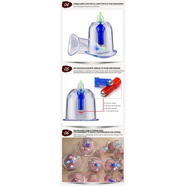 Instrument classification Class I 32pcs Cupping Massage Kit with Diamond Pattern