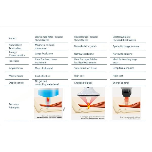 Electromagneto Shock Wave Focused Type Focus Shockwave Healing Source for Precise Treatment of Musculoskeletal Conditions