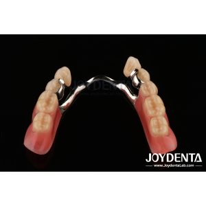 Framework Setup Teeth Finish Elaborate Technology Beautiful Harmonious