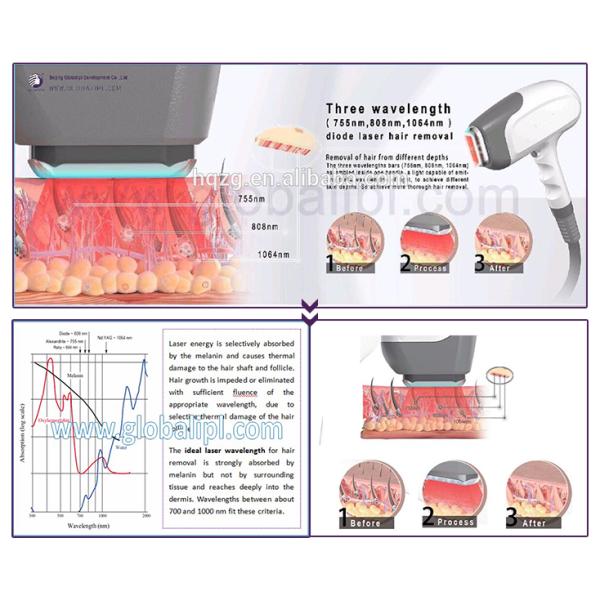 High Safety Diode Laser Hair Removal Machine 5 ~ 400ms Adjustable Pulse Width