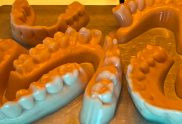 Model Resin Dental Solid Shape Retention Post-cooling Enhanced Durability