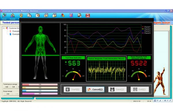 Quantum Sub Health Analyzer , Body Composition Analyser