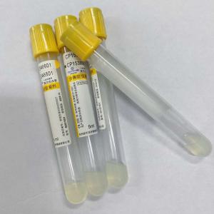 China 5ml SST Gel Clot Activator Blood Collection Tube Yellow Cap on sale