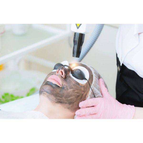 best laser tattoo removal machine