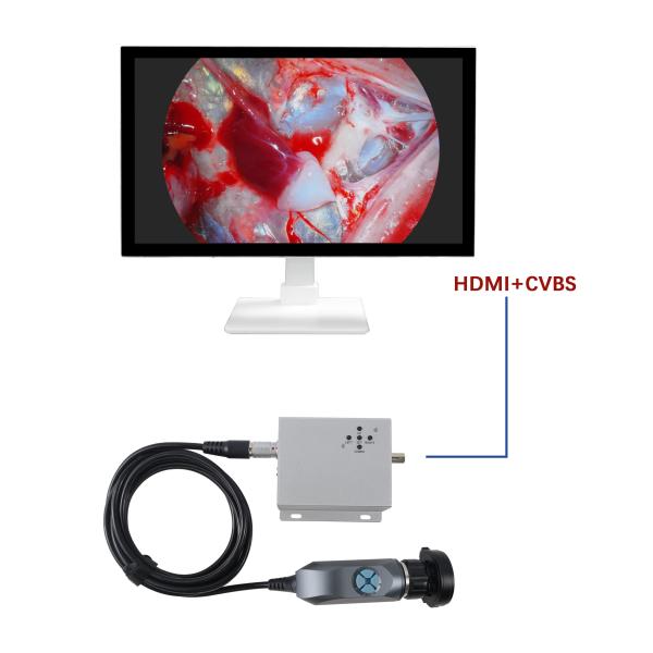 Versatile 2-Output Portable Endoscope for Real-Time Diagnostics
