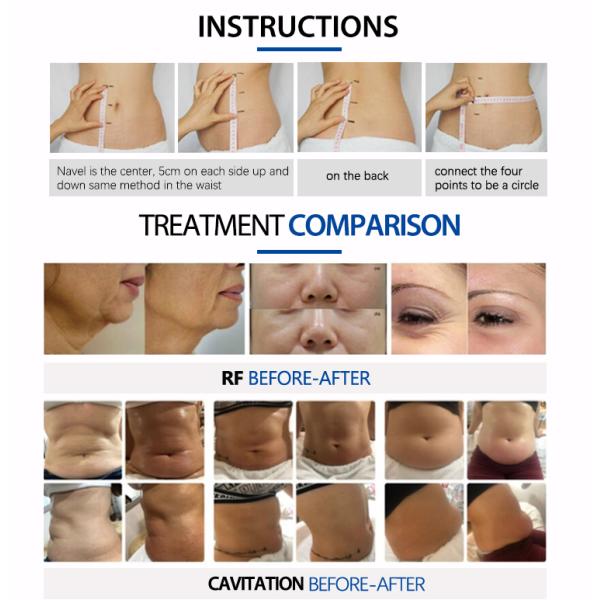 Multi-Language Cellulite Reduction Slimming Cavitation Machine with Vacuum RF Technology