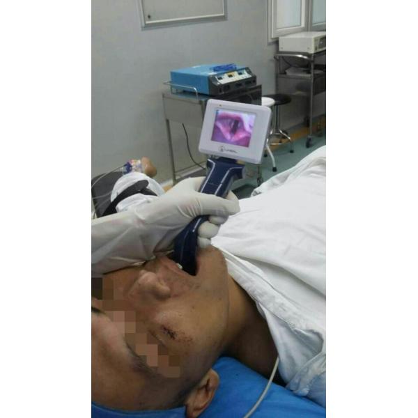 Operating Portable Video Laryngoscope Using In Routine Endotracheal Intubation