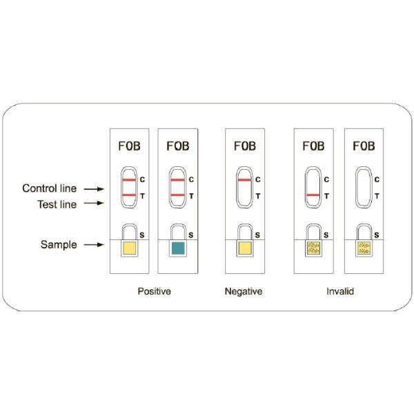 One Step Tumor Marker Immuno FOB Fast Diagnostic Cassette