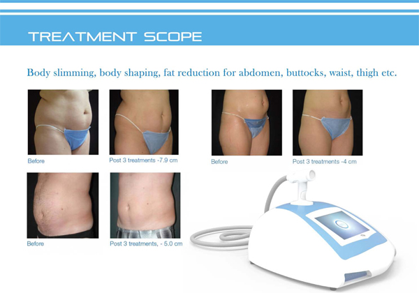 Portable low risk HIFU Shape Slimming Machine LED Working Indicator Light
