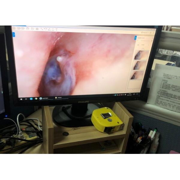 4 Led Cold Light Continuous Working Time 10h Digital Ear Scope