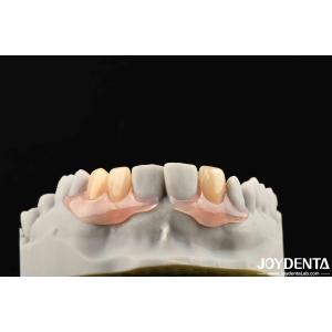 Stable Oral Structure Effect Framework Set UP Teeth Finish Beautiful And