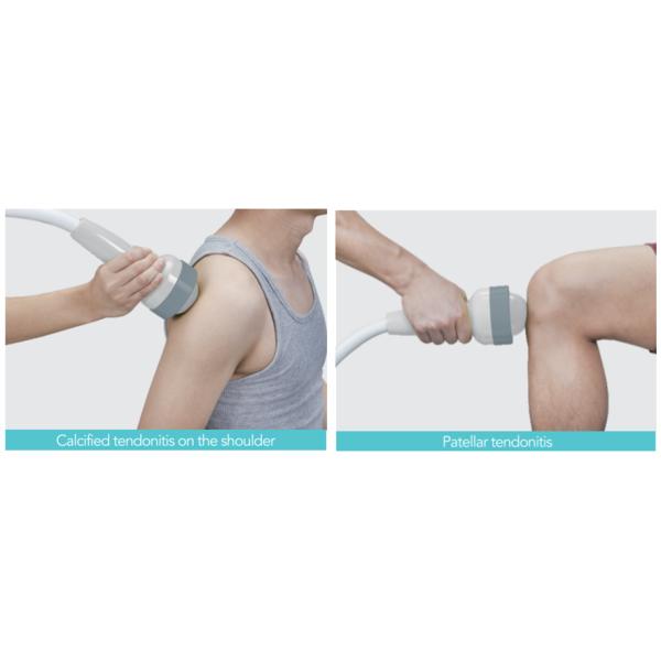 Professional Electromagnetic Extracorporeal Shockwave Therapy Machine for hospital use