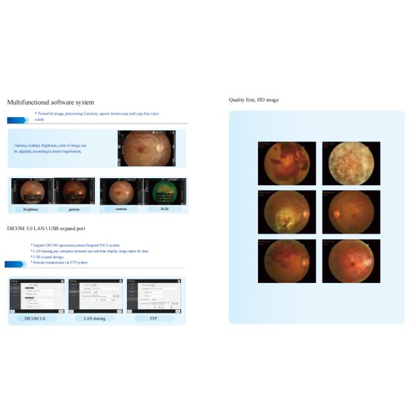 Automatic Chinrest Fundus Camera Photography Machine Adjusting Pupil Searching Alignment