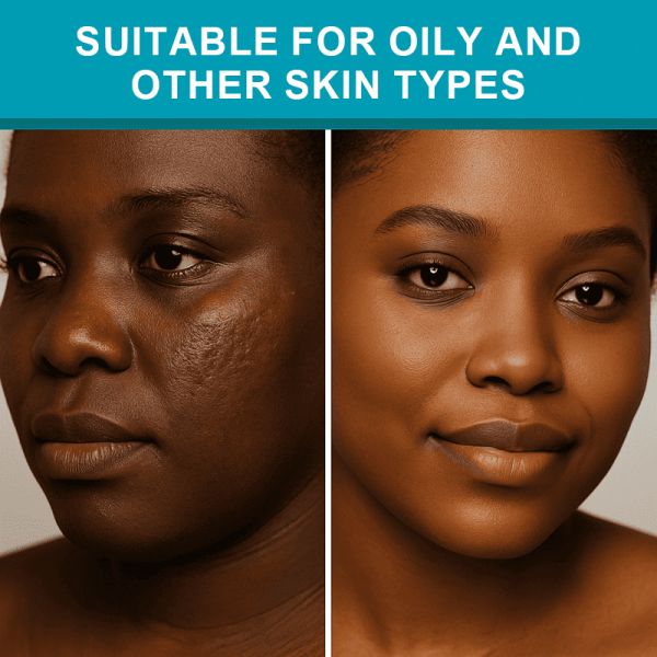 Scar Repair Cream - Effectively removes new and old scars, surgical scars, post-cesarean section scars, burn scars, scald scars, and pathological