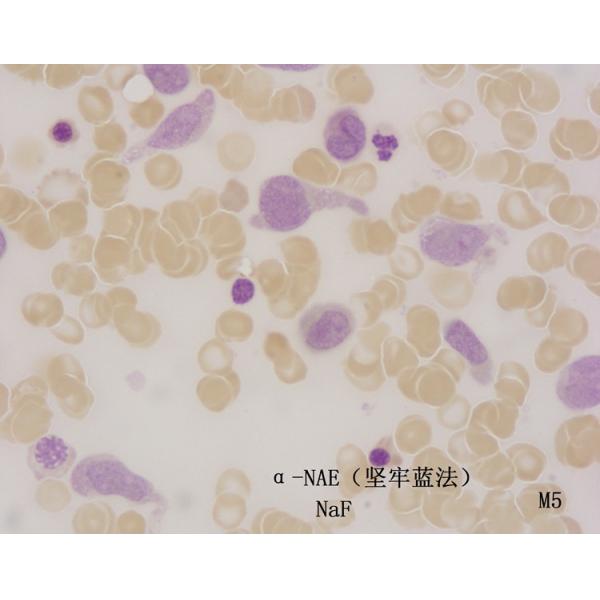 a-Naphthyl Acetate Esterase Stain (a-NAE) (Fast blue method) 100 Tests for Healthcare Facility