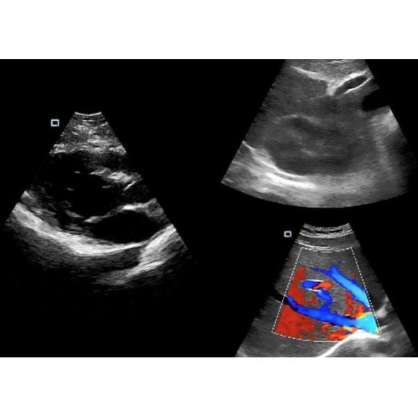 Color Doppler Ultrasound Probe Handheld Ultrasound Device For Mobilephone / PC