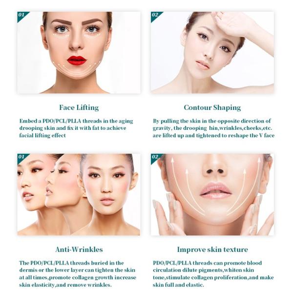 23G Face Lift PDO Thread Non Surgical Multi Threads L Needle