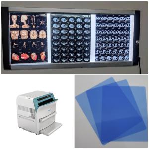 Quality 20x25cm Blue Transparent PET Thermal Medical Dry Film For Fuji Printer for sale