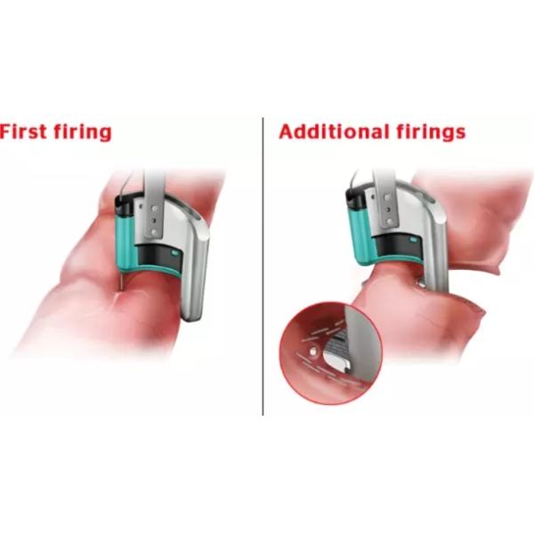 Transanal Procedure Curved Cutter Stapler / Surgical Stapling Devices