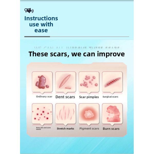 Repairable Abrasion Scar Removal Cream Repairable Laceration Scar Treatment Cream