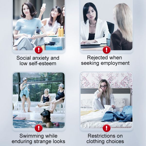 Scar repair cream, medical-grade silicone gel formula, reduces scarring.