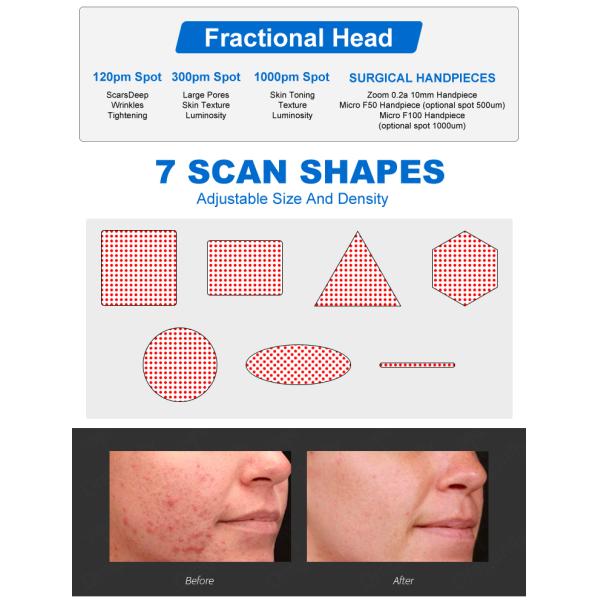 Advanced Four Treatment Modes Co2 Fractional Laser Machine Effective Stretch Marks Removal