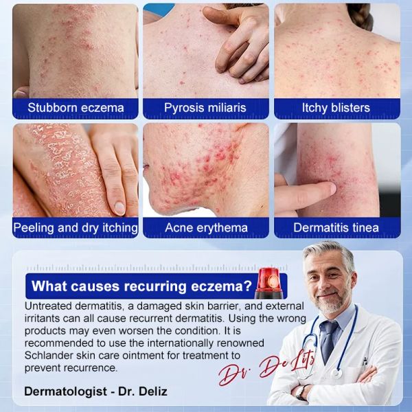Renhe Medical Eczema Spray. Professionally relieves all symptoms caused by eczema!