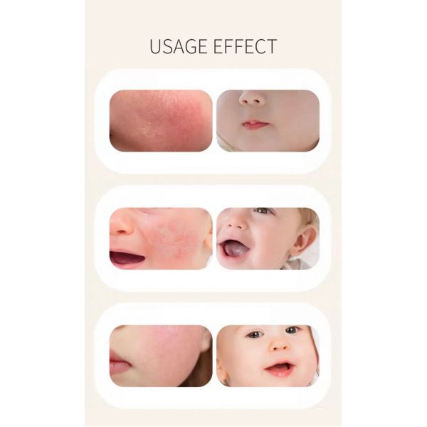 Children'S Calendula Moisturizer Calming Nourishing Soothing Cream Anti Inflammatory 20g