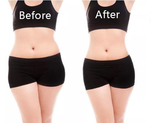 Fat Dissolving Injections To Lose Weight And Shape