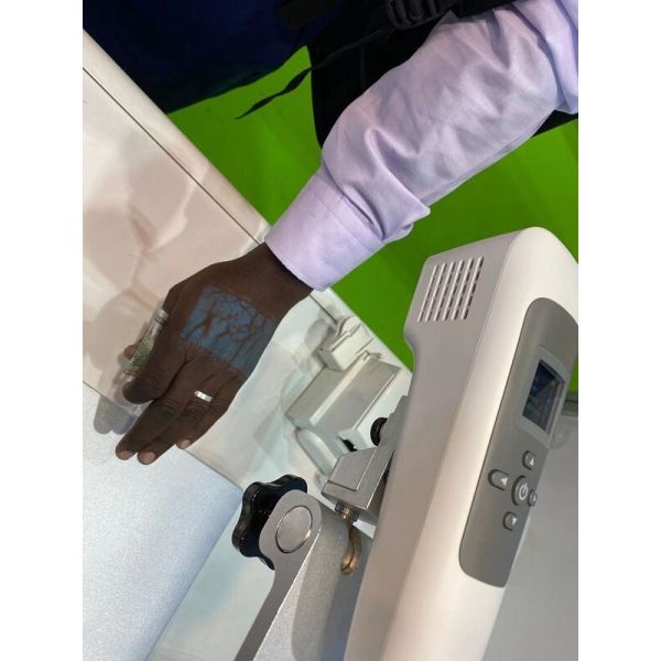 Clinical application of vascular access solution in medical setting