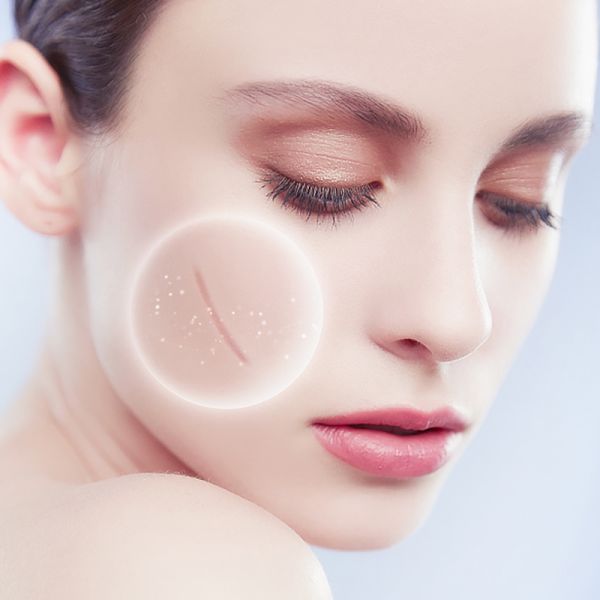 Scar repair cream, medical-grade silicone gel formula, reduces scarring.