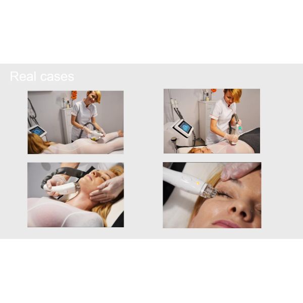 Cavitation+Vacuum+RF+Laser+Roller System Slimming non invasive liposuction machine CE