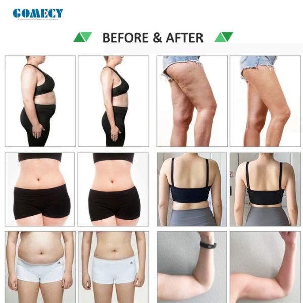 10D Laser Body Shaping Machine