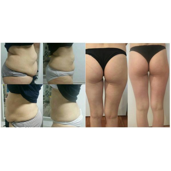 Body Slimming Non Invasive Lipo Machine / Diode Laser Rf Slimming Machine