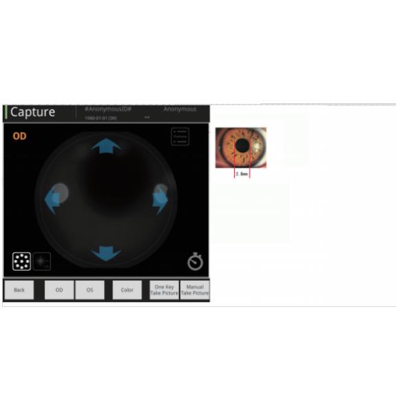 Professional Non Mydriatic Fundus Camera For Accurate Imaging