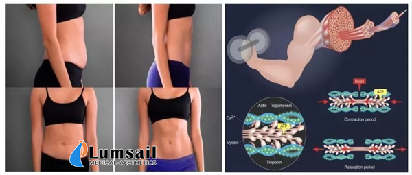 HIEMT Electromagnetic Muscle Stimulation Device Cellulite Reduction