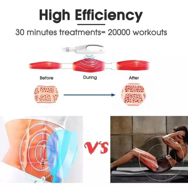 em sculpting machine how it works