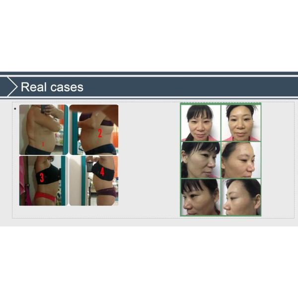 Cavitation+Vacuum+RF+Laser+Roller System Slimming non invasive liposuction machine CE