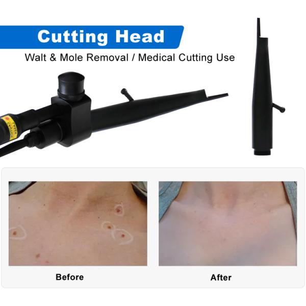 Advanced Four Treatment Modes Co2 Fractional Laser Machine Effective Stretch Marks Removal
